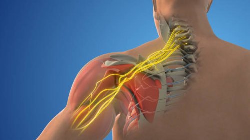 Le syndrome du défilé cervico-thoraco-brachial et la chiropraxie